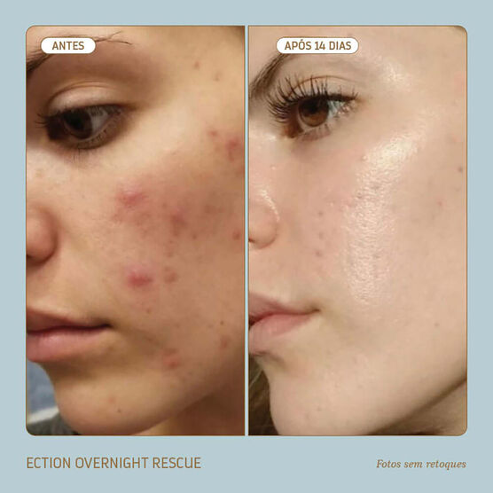 Hidratante Noturno Repara&ccedil;&atilde;o Profunda Biossance SQUALANE ECTOIN OVERNIGHT RESCUE